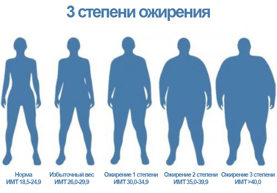 3 степени ожирения фото